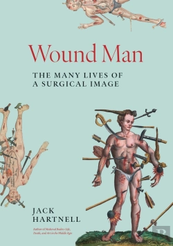 Bertrand.pt - Wound Man