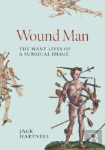 Wound Man