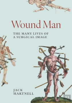 Bertrand.pt - Wound Man
