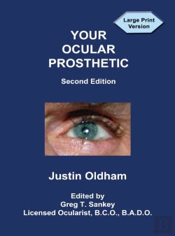 Bertrand.pt - Your Ocular Prosthetic
